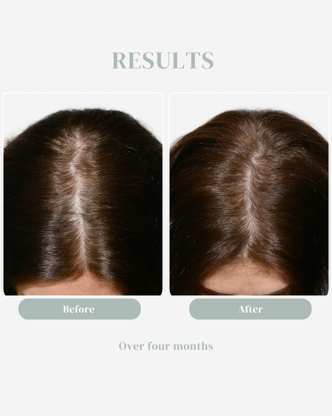 The Scalp System for thinning & hair growth