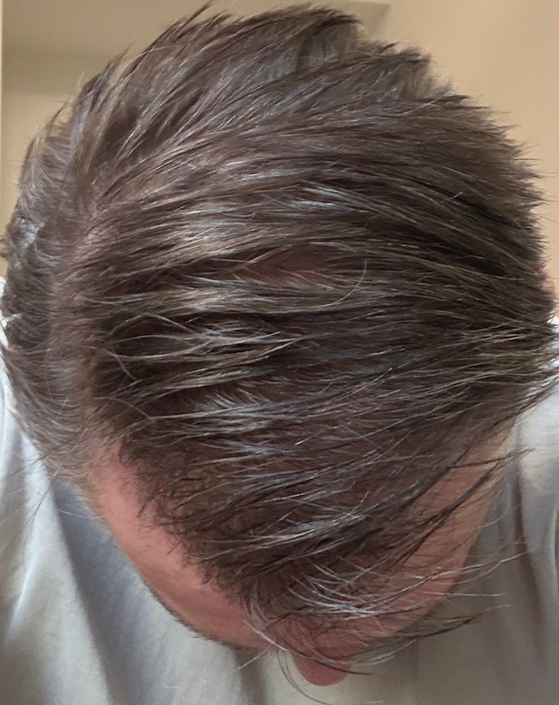 After